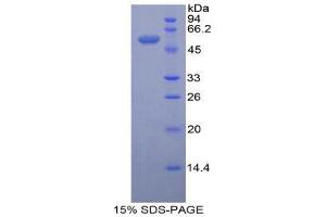 SDS-PAGE (SDS) image for Ectonucleotide Pyrophosphatase/phosphodiesterase 1 (ENPP1) (AA 568-789) protein (His tag,GST tag) (ABIN1877753) (ENPP1 Protein (AA 568-789) (His tag,GST tag))
