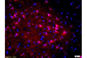 Formalin-fixed and paraffin-embedded rat brain labeled with Anti-Calbindin/Calbindin D28k Polyclonal Antibody, Unconjugated (ABIN703691) 1:200, overnight at 4 °C, The secondary antibody was Goat Anti-Rabbit IgG, Cy3 conjugated used at 1:200 dilution for 40 minutes at 37 °C. (CALB1 antibody)