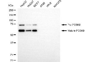 Western blotting analysis using PCSK9 antibody (ABIN7799929).