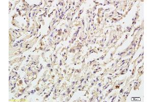 Formalin-fixed and paraffin embedded human endometrial tissue labeled with Anti Caspase-9 p10 Polyclonal Antibody, Unconjugated (ABIN1387603) at 1:200 followed by conjugation to the secondary antibody and DAB staining (Caspase 9 antibody  (AA 351-416))