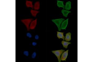 ABIN6264935 and ABIN6276742 staining Hela cells(30 min of UV treatment) by IF/ICC.
