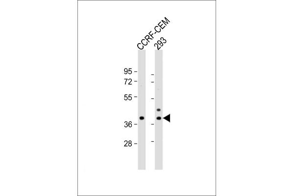 CCDC122 antibody  (C-Term)