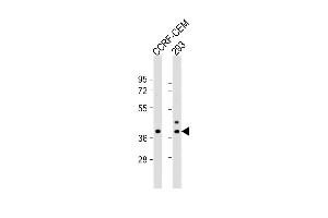 All lanes : Anti-CCD Antibody (C-term) at 1:1000 dilution Lane 1: CCRF-CEM whole cell lysate Lane 2: 293 whole cell lysate Lysates/proteins at 20 μg per lane. (CCDC122 antibody  (C-Term))