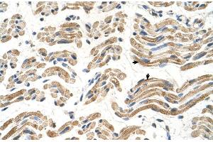 Human Muscle (ALDH4A1 antibody  (C-Term))