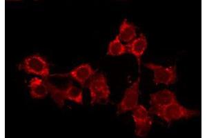 ABIN6278577 staining Hela by IF/ICC. (HCN2 antibody  (Internal Region))