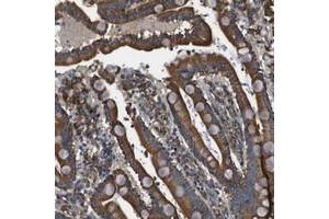 Immunohistochemical staining of human duodenum with CNPY3 polyclonal antibody  shows strong cytoplasmic positivity in glandular cells at 1:200-1:500 dilution. (TNRC5 antibody)