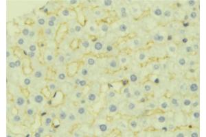 ABIN6277044 at 1/100 staining Mouse liver tissue by IHC-P. (AK4 antibody  (Internal Region))