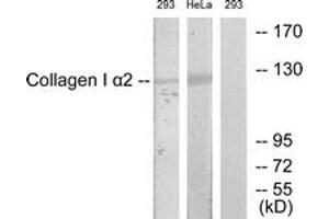 Western blot analysis of extracts from 293/HeLa cells, using Collagen I alpha2 Antibody.