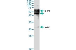 Immunoprecipitation of PDCD2 transfected lysate using anti-PDCD2 MaxPab rabbit polyclonal antibody and Protein A Magnetic Bead , and immunoblotted with PDCD2 MaxPab rabbit polyclonal antibody (D01) . (PDCD2 antibody  (AA 1-344))