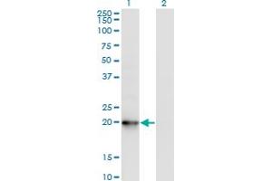 Western Blot analysis of COMMD1 expression in transfected 293T cell line by COMMD1 monoclonal antibody (M03), clone 2B12.