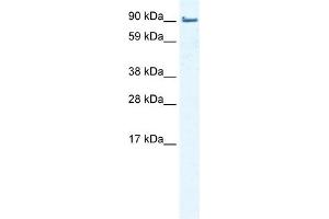 WB Suggested Anti-EPLIN Antibody Titration:  0. (LIMA1 antibody  (Middle Region))