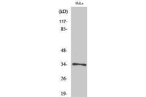 Western Blotting (WB) image for anti-Cyclin-Dependent Kinase 1 (CDK1) (pThr161) antibody (ABIN3181952) (CDK1 antibody  (pThr161))