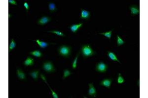 Immunofluorescence staining of SH-SY5Y cells with ABIN7165023 at 1:133, counter-stained with DAPI. (MLLT11 antibody  (AA 1-90))