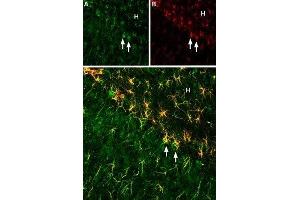 Expression of Ciliary neurotrophic factor (CNTF) in rat hippoccampus - Immunohistochemical staining of rat hippoccampus using Anti-CNTF Antibody (ABIN7043070 and ABIN7044789), (1:200). (CNTF antibody  (AA 164-177))