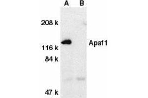 Western blot analysis of Apaf1 in human heart tissue lysate with AP30056PU-N Apaf1 antibody at 1 μg/ml dilution in the absence (A) or presence (B) of blocking peptide. (APAF1 antibody  (C-Term))