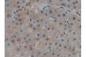 IHC-P analysis of Human Liver Tissue, with DAB staining. (MT-ND1 antibody  (AA 186-270))