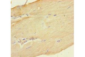 Immunohistochemistry of paraffin-embedded human skeletal muscle tissue using ABIN7149702 at dilution of 1:100 (Deoxyguanosine Kinase antibody  (AA 40-277))