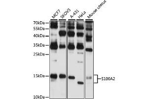 Western blot analysis of extracts of various cell lines, using S100 antibody (ABIN6128692, ABIN6147343, ABIN6147344 and ABIN6216356) at 1:3000 dilution. (S100A2 antibody  (AA 1-97))