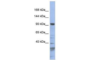 WB Suggested Anti-MYO1C Antibody Titration: 0. (Myosin IC antibody  (N-Term))