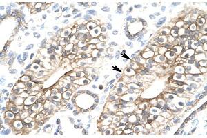 Human kidney; FLJ11730 antibody - N-terminal region in Human kidney cells using Immunohistochemistry (MEAF6 antibody  (N-Term))