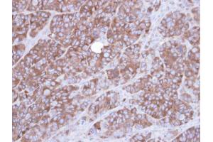 IHC-P Image Immunohistochemical analysis of paraffin-embedded SW480 xenograft , using Alpha-actinin 1, antibody at 1:100 dilution. (ACTN1 antibody)