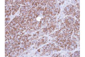 IHC-P Image Immunohistochemical analysis of paraffin-embedded SW480 xenograft , using Alpha-actinin 1, antibody at 1:100 dilution. (ACTN1 antibody)