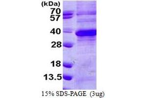 SDS-PAGE (SDS) image for Regucalcin (RGN) (AA 1-299) protein (His tag) (ABIN667537)