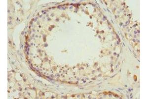 Immunohistochemistry of paraffin-embedded human testis tissue using ABIN7142076 at dilution of 1:100 (RDH5 antibody  (AA 24-318))