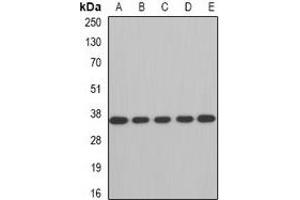 Western blot analysis of AUH expression in A549 (A), SW480 (B), mouse brain (C), mouse kidney (D), rat heart (E) whole cell lysates. (AUH antibody)