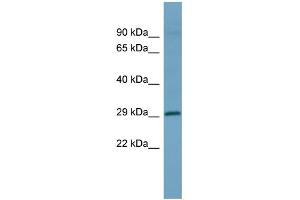 WB Suggested Anti-HOXD1 Antibody Titration: 0. (HOXD1 antibody  (Middle Region))
