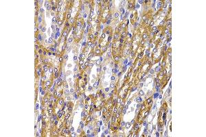 Immunohistochemistry of paraffin-embedded rat kidney using ATP1A1 antibody (ABIN5995394) at dilution of 1/100 (40x lens). (ATP1A1 antibody)