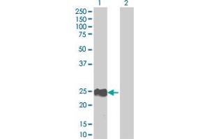 Western Blot analysis of RAB22A expression in transfected 293T cell line by RAB22A MaxPab polyclonal antibody.