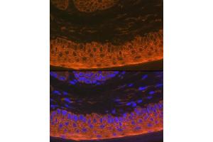 Immunofluorescence analysis of rat skin using Cytokeratin 16 (KRT16) Rabbit mAb (ABIN7268094) at dilution of 1:100 (40x lens). (KRT16 antibody)