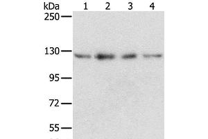 Western Blot analysis of Huvec, hepg2, 293T and A549 cell using RBM5 Polyclonal Antibody at dilution of 1:500 (RBM5 antibody)