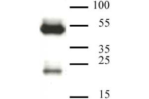 CAF-1 p60 antibody (mAb) tested by Western blot. (CHAF1B antibody)