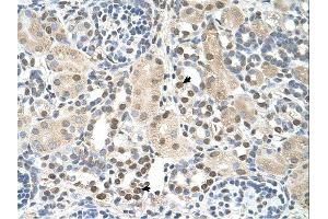 PSAT1 antibody was used for immunohistochemistry at a concentration of 4-8 ug/ml. (PSAT1 antibody  (N-Term))