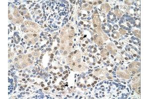 PSAT1 antibody was used for immunohistochemistry at a concentration of 4-8 ug/ml. (PSAT1 antibody  (N-Term))