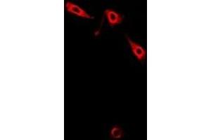 Immunofluorescent analysis of Pinch-1 staining in A549 cells. (LIMS1 antibody)