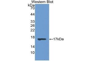 Detection of Recombinant RBP1, Rat using Polyclonal Antibody to Retinol Binding Protein 1, Cellular (RBP1) (RBP1 antibody  (AA 2-135))