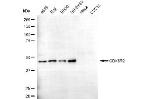 anti-Cyclin-Dependent Kinase 5, Regulatory Subunit 2 (p39) (CDK5R2) antibody