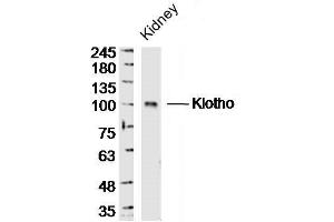 Mouse kidney lysates probed with Klotho Polyclonal Antibody, unconjugated  at 1:300 overnight at 4°C followed by a conjugated secondary antibody at 1:10000 for 90 minutes at 37°C. (Klotho antibody  (AA 401-500))