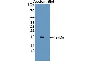 Detection of Recombinant LCNL1, Rat using Polyclonal Antibody to Lipocalin Like Protein 1 (LCNL1) (LCNL1 antibody)