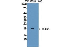 Detection of Recombinant LCNL1, Rat using Polyclonal Antibody to Lipocalin Like Protein 1 (LCNL1) (LCNL1 antibody)