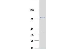 Western Blotting (WB) image for Carbohydrate (N-Acetylgalactosamine 4-Sulfate 6-O) Sulfotransferase 15 (CHST15) protein (Myc-DYKDDDDK Tag) (ABIN2714187)