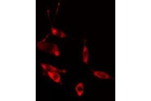 ABIN6275465 staining HeLa cells by IF/ICC. (RAB31 antibody  (Internal Region))