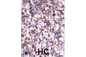Image no. 2 for anti-beta-Site APP-Cleaving Enzyme 2 (BACE2) (C-Term), (Isoform C) antibody (ABIN358586)