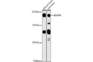 Western blot analysis of extracts of various cell lines, using VEGFR1 antibody (ABIN1683256, ABIN3015026, ABIN3015027 and ABIN6213602) at 1:1000 dilution. (FLT1 antibody  (AA 1100-1200))