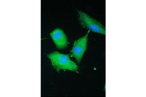 IF analysis of PARN using anti-PARN antibody (ABIN5693032). (PARN antibody  (AA 1-301))