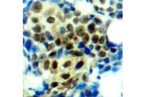 Immunohistochemistry (IHC) image for anti-Mitogen-Activated Protein Kinase 3 (MAPK3) (pThr185) antibody (ABIN3019887)