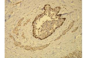 Immunohistochemistry (IHC) image for anti-Keratin 14 (KRT14) (AA 455-471), (C-Term) antibody (ABIN870555) (KRT14 antibody  (C-Term))